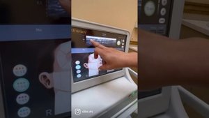 Диагностика перед смас лифтингом в клинике O'LIVE