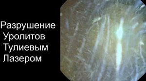 Удаление камней из мочевого пузыря у собаки. Без разреза.