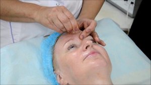 Вакуумный массаж лица -зона лба.
