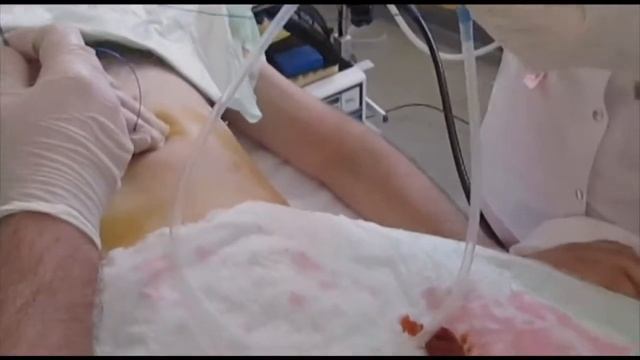 gastrostoma смотреть онлайн