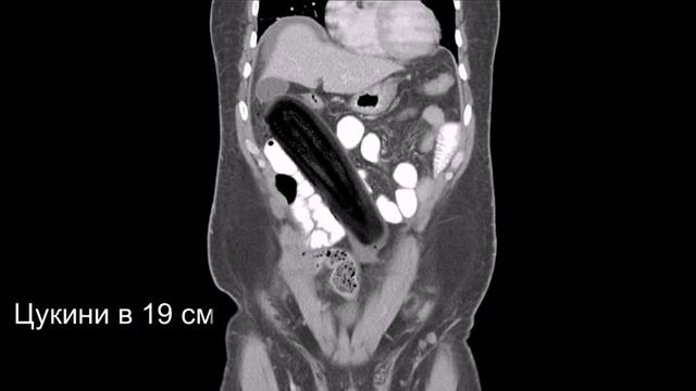 Мед тридцатка #3. Необычные рентгенограммы смотреть онлайн