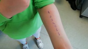 АЛЛЕРГИЯ ?/Делаем ТЕСТ на АЛЛЕРГИЮ в Kocaeli Üniversitesi Hastanesi