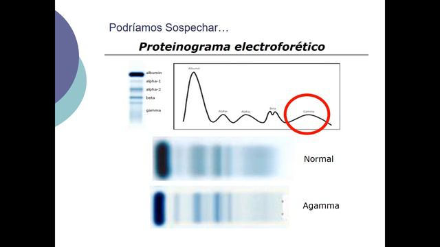 2016/08 - Agammaglobulinemia ligada al cromosoma X смотреть онлайн