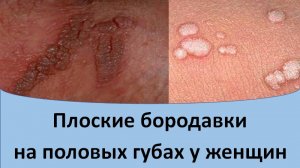 Плоские бородавки на половых губах у женщин
