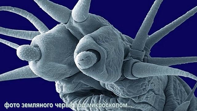 3 Под микроскопом насекомые смотреть онлайн