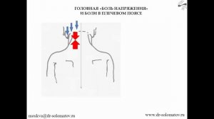 ГОЛОВНАЯ БОЛЬ НАПРЯЖЕНИЯ ИЗ-ЗА ШЕЙНОГО ОТДЕЛА ПОЗВОНОЧНИКА (Лекции доктора Соломатова В.Г.)