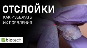ОТСЛОЙКИ🤦🏽♀️ЧТО ДЕЛАТЬ, ЧТОБЫ ИХ НЕ БЫЛО!