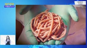 7-класс | Биология | Тип круглые черви. Класс нематоды  Приспособлениe к паразитизму