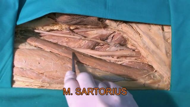 Trigonum femorale, fossa iliopectinea (HD) смотреть онлайн