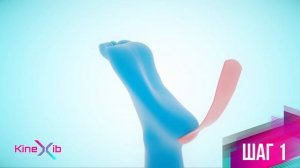 Kinexib - тейпирование плоскостопия