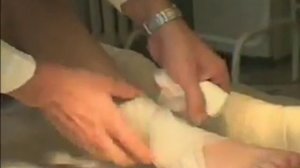 Восьмиобразная повязка на голеностопный сустав