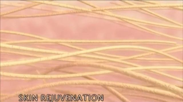 Фотоомоложение - Skin Rejuvenation смотреть онлайн