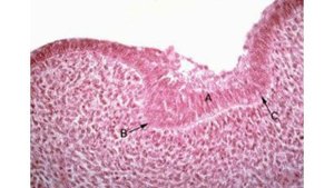 Развитие зубов, часть 1