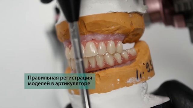 Регистрация центральной окклюзии  быстро и точно