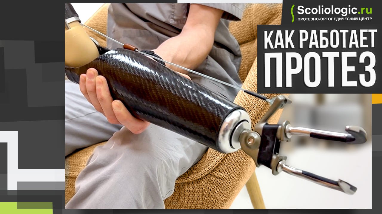 Как работает протез