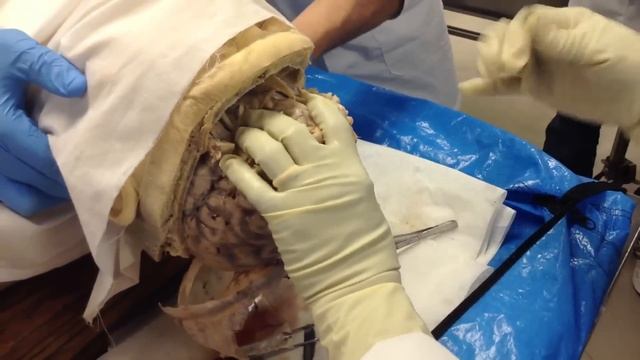 1 Dissection of the Cranial Cavity смотреть онлайн