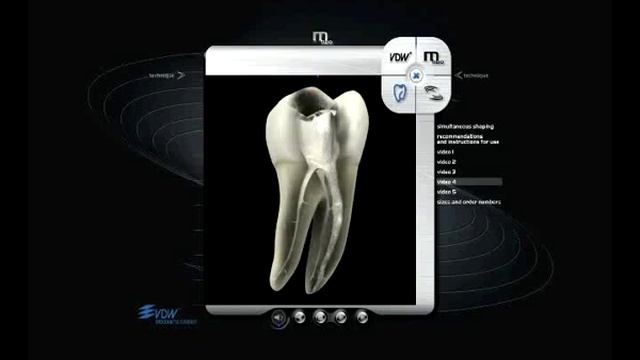 Эндоинструменты Mtwo VDW(2).avi смотреть онлайн