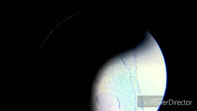 КАК ВЫГЛЯДИТ НЕРВ ПОД УВЕЛИЧЕНИЕМ ???¦ микроскоп часть 2
