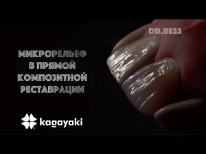 Микрорельеф в прямой композиционной реставрации @Kagayaki.polish протокол Марии Бессоновой