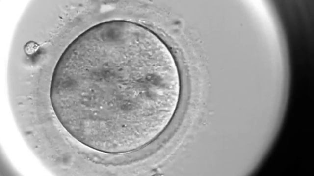 Преимплантационное генетическое тестирование смотреть онлайн