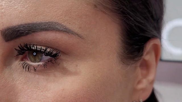 Токсин ПОСЛЕ(рефайнекс через 14 дней) смотреть онлайн