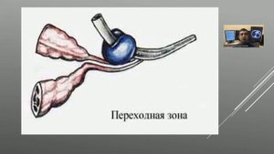 УЗ анатомия предстательной железы