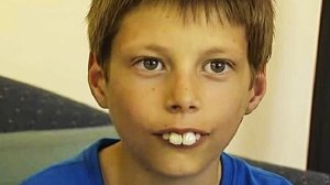 В 12 лет его называли мальчиком с самыми большими зубами, как сложилась его судьба