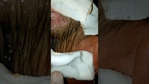 Военно-полевая хирургия. Южный фронт. Осень. с.Октябрь. Новоазовский район.