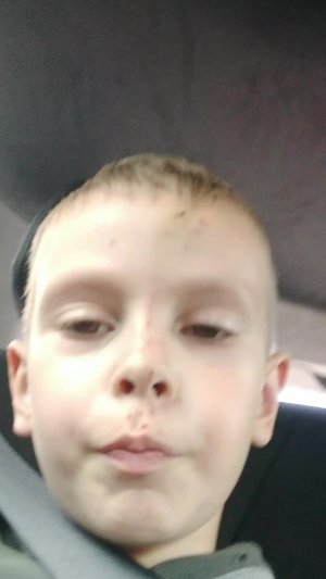 если что-то у меня с лицом страшного ничего нет