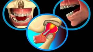 Боли в челюстном суставе