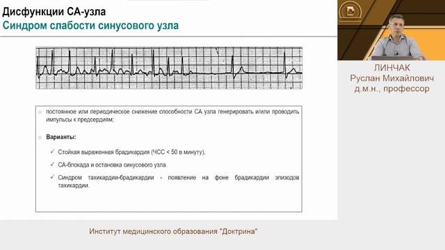 Дисфункция синоатриального и атриовентрикулярного узлов