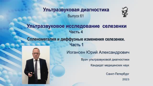 УЗИ. Доктор Иогансен. Выпуск 61. Спленомегалия и диффузные изменения селезенки. Часть 1.