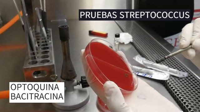 IDENTIFICACIÓN DE STREPTOCOCCUS Y ENTEROCOCCUS смотреть онлайн
