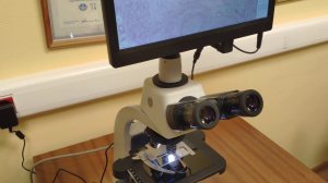 60 кадров в секунду на Full HD ЖК дисплее 11,6" смонтированном на XFCAM1080P камере и микроскопе