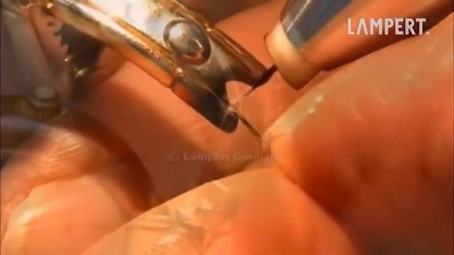 Ремонт золотого ремешка