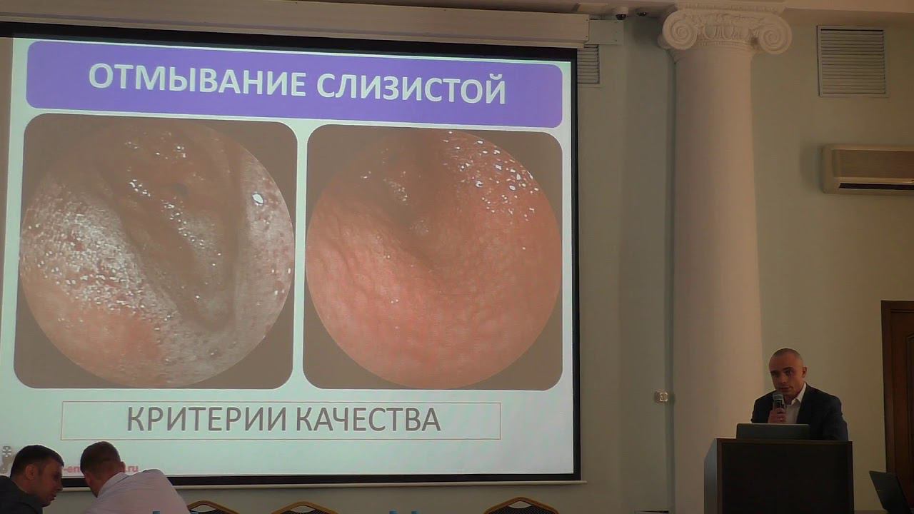 08 Корнеев АА Качественная эндоскопия без экспертных эндоскопов