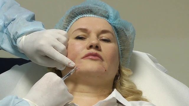 Коррекция филлерами подбородка. смотреть онлайн