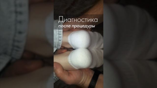 Таз перекошен конкретно! Хотя лопатки ровные. Акупрессура подзатылочных мышц. Акупрессура - Россия