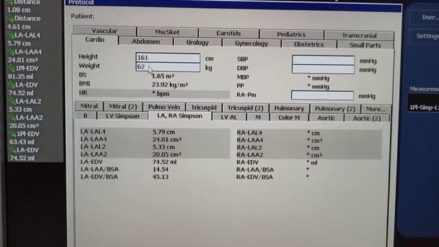 Передний инфаркт миокарда Маленький тромбус Методика измерения левого предсердия смотреть онлайн