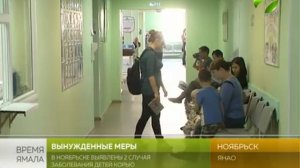 Диагноз «корь». В Ноябрьске заболели двое непривитых детей