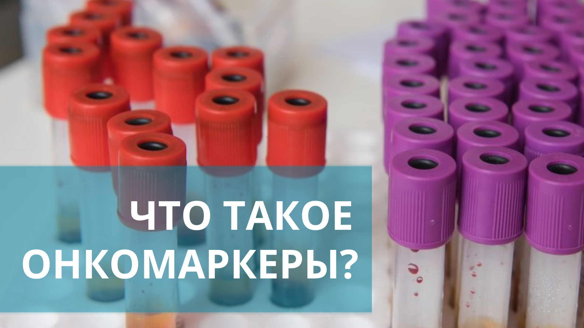 ? Онкомаркеры: что это такое, и когда нужно сдавать анализ на онкомаркеры? Онкомаркеры. 18+