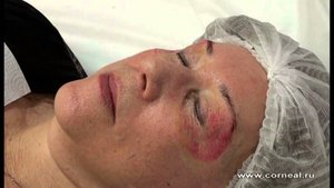 Пилинг для глаз - щипит всего пару секунд