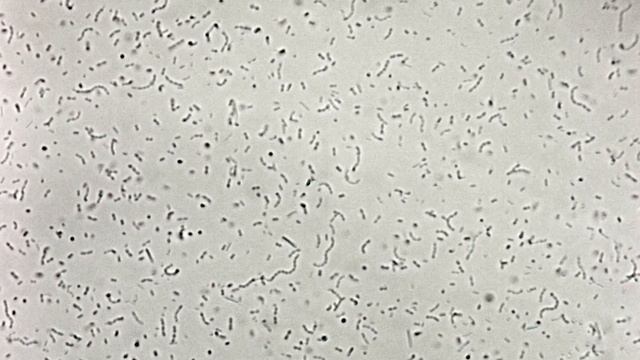 Streptococcus thermophilus (стрептококк термофильный) смотреть онлайн