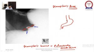 Radiology image based session- GIT for FMGE/NEET