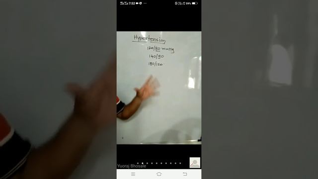 Measurement of blood pressure By- Yuoraj Bhosale. смотреть онлайн