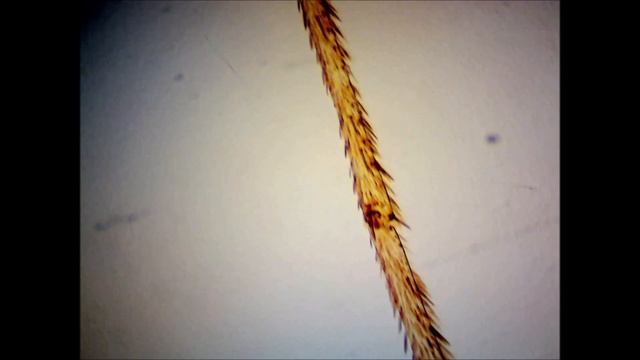 13 Конечность комара, 2 Мп, 40х смотреть онлайн