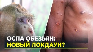 Оспа обезьян: чем опасна, кто в группе риска и как передаётся человеку