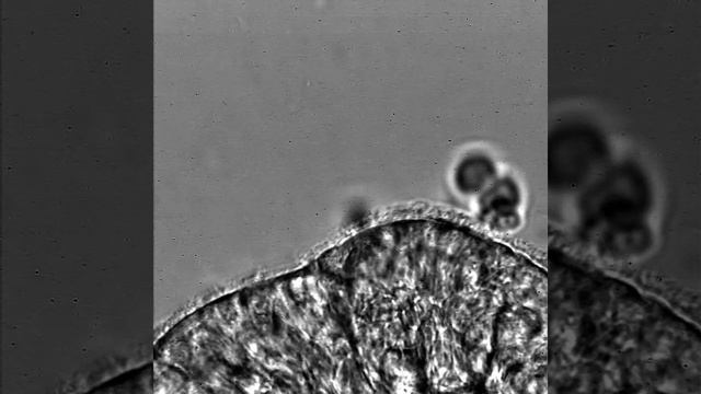 Close up of cilia beating смотреть онлайн