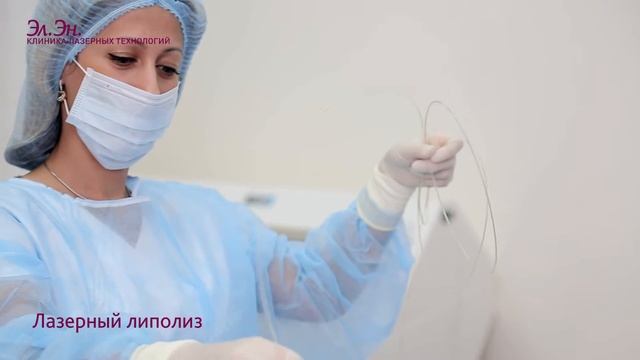 Лазерный липолиз на аппарате SmartLipo (DEKA) Италия