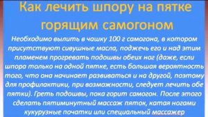Лечение пяточной шпоры. Советы бабушки.